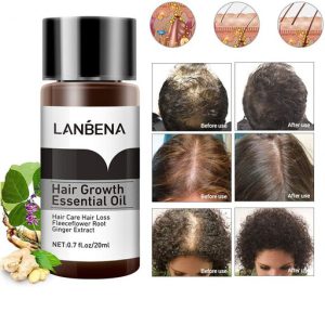 روغن ضد ریزش لانبنا