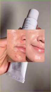 ترمیم کننده